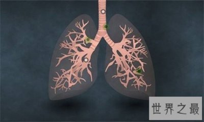 ​中国十大高发恶性肿瘤，早知征兆早预防