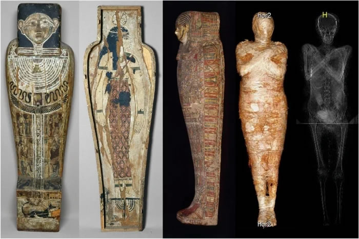 波兰华沙国立艺术博物馆木乃伊Hor-Djehuty怀孕了