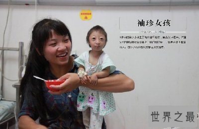 ​中国女童身高只有54厘米，可能是世界上最矮的人