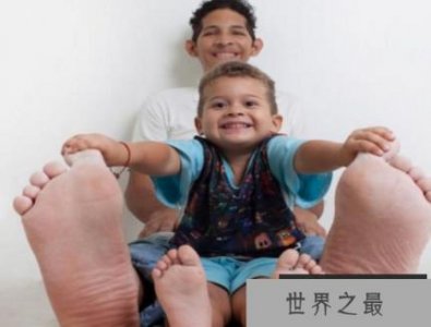 ​总结一下吉尼斯世界纪录中最大的脚高达40厘米