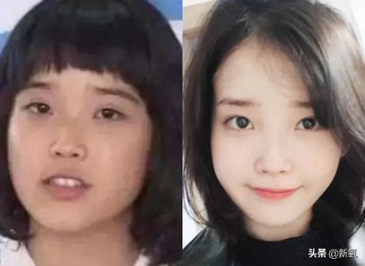 ​光子嫩肤能美白吗 能最大限度提升颜值的手段是美白？