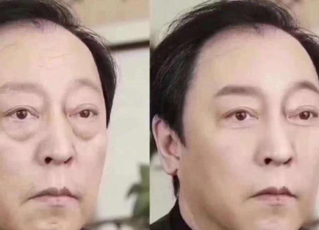 下眼袋松弛怎么办简单去眼袋方法（女人长眼袋太显老）(8)