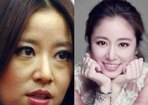 下眼袋松弛怎么办简单去眼袋方法（女人长眼袋太显老）(2)