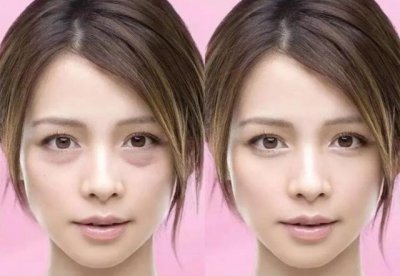 ​下眼袋松弛怎么办简单去眼袋方法（女人长眼袋太显老）