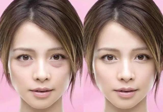 下眼袋松弛怎么办简单去眼袋方法（女人长眼袋太显老）(1)