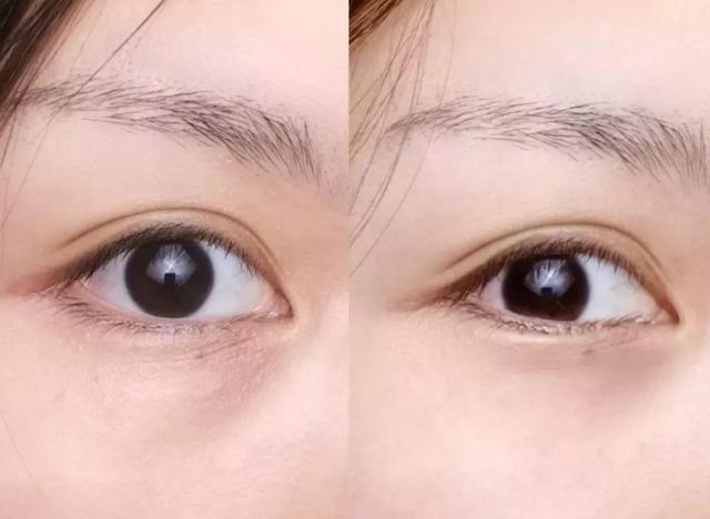 下眼袋松弛怎么办简单去眼袋方法（女人长眼袋太显老）(18)