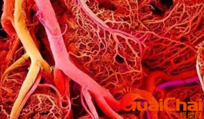 ​血管炎早期的四大症状是什么？血管炎在身体内潜伏多长时间？