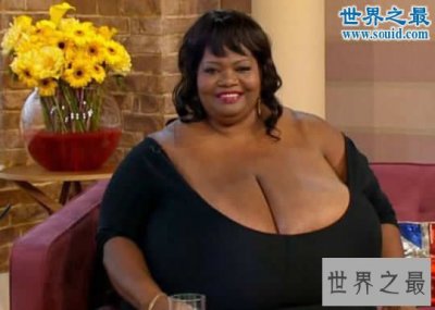 ​世界上最大的天然乳房，双乳重达77斤(图)