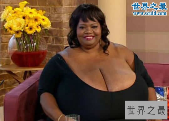 世界上最大的天然乳房,双乳重达77斤(图)