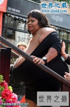 世界上最大的天然乳房,双乳重达77斤(图)