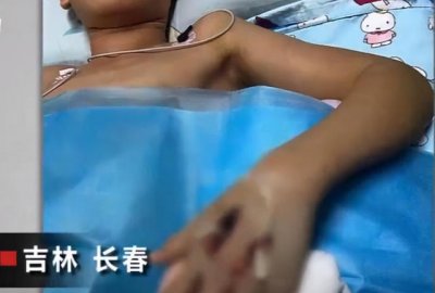 ​竹叶青蛇被咬会死吗（少年被咬一口进ICU差点送命）