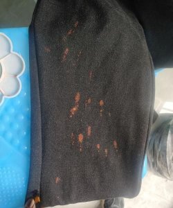 ​黑衣服变红了咋办,黑色衣服发红怎么补救最简单