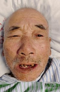 ​南宁市寻亲：七旬老人被救助，高1米65