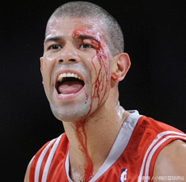 NBA史上5大不忍直视的受伤，乔治利文斯顿断腿太可怕！