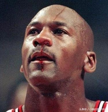 NBA史上5大不忍直视的受伤，乔治利文斯顿断腿太可怕！