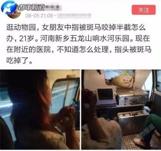 ​可怕斑马咬掉女游客半截手指再也别这么逗动物了