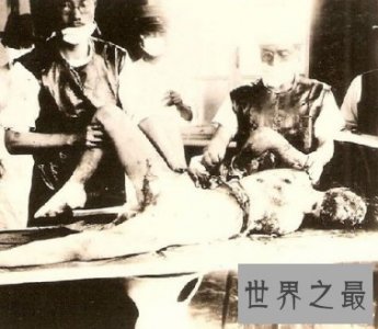 ​无一人幸存的活体实验 731部队之女体实验