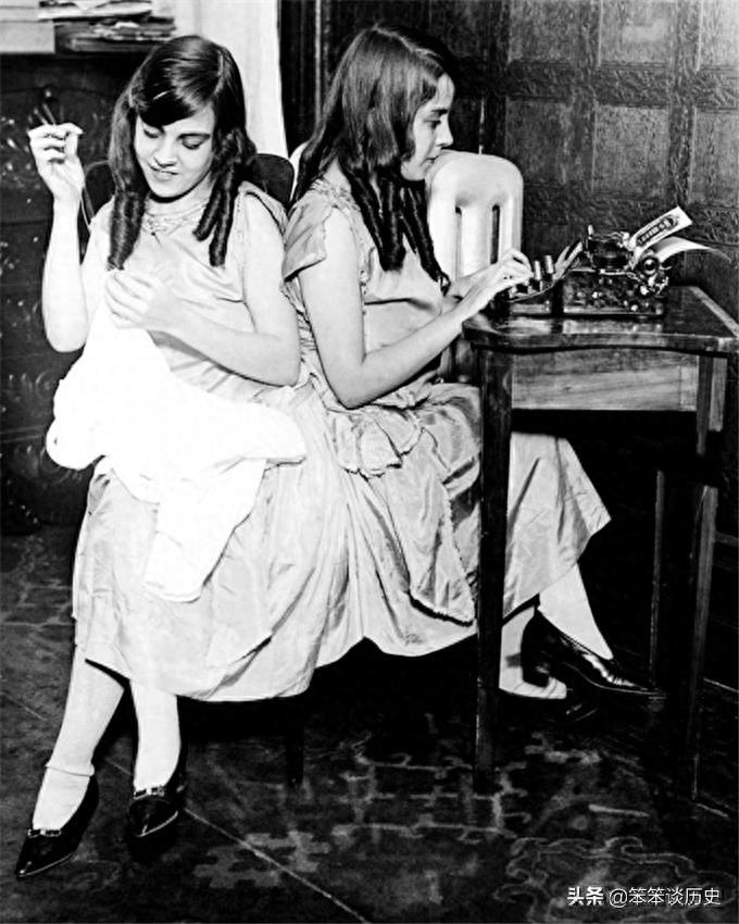 世界上最著名的连体双胞胎 被霸占20年境遇好凄惨