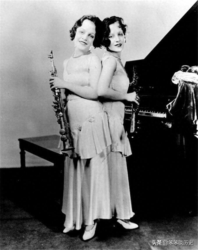 世界上最著名的连体双胞胎 被霸占20年境遇好凄惨