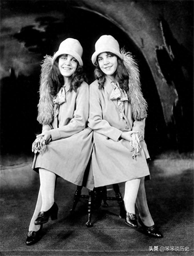 世界上最著名的连体双胞胎 被霸占20年境遇好凄惨